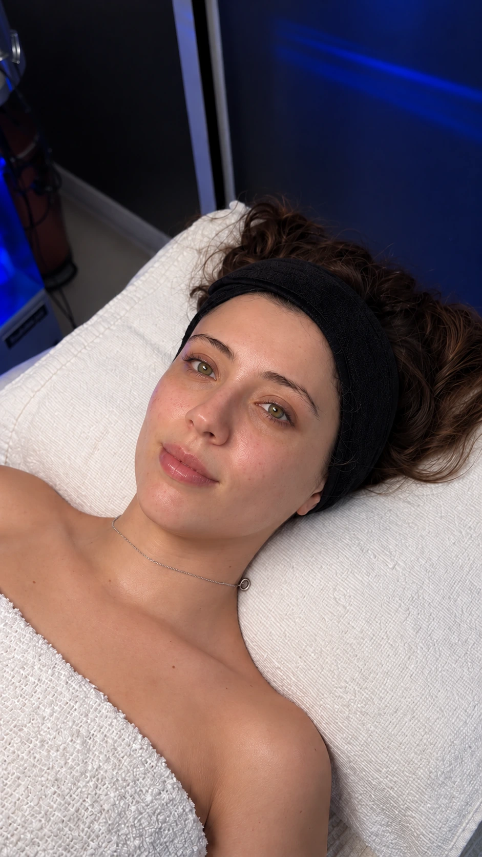 Mariana: fotografía antes aportada para el comparativo Hydrafacial